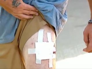 连开8枪，致一无辜平民受伤，涉事警察或面临重罪起诉！美国警方：敲错了房门